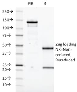 Transglutaminase 2/TGM2 Antibody (TGM2/419), Novus Biologicals 0.2mg; Unlabeled:Antibodies,